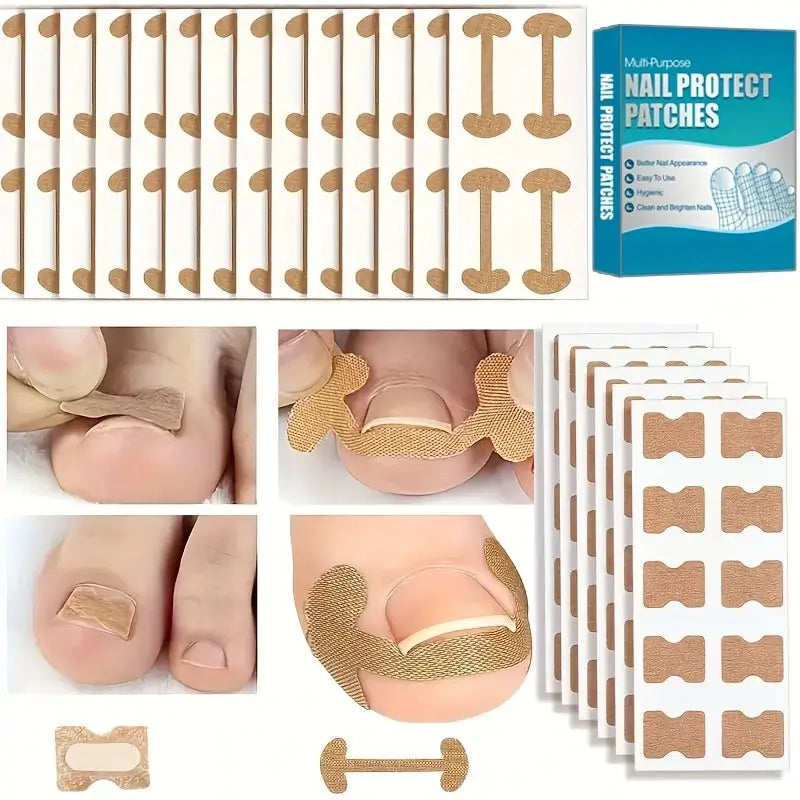 Toenail Correction Strips + Free Toenail Sticks